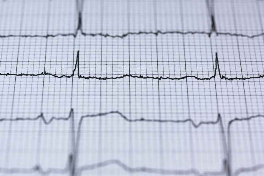 Understanding Atrial Fibrillation: A Common Heart Rhythm&nbsp;Disorder
