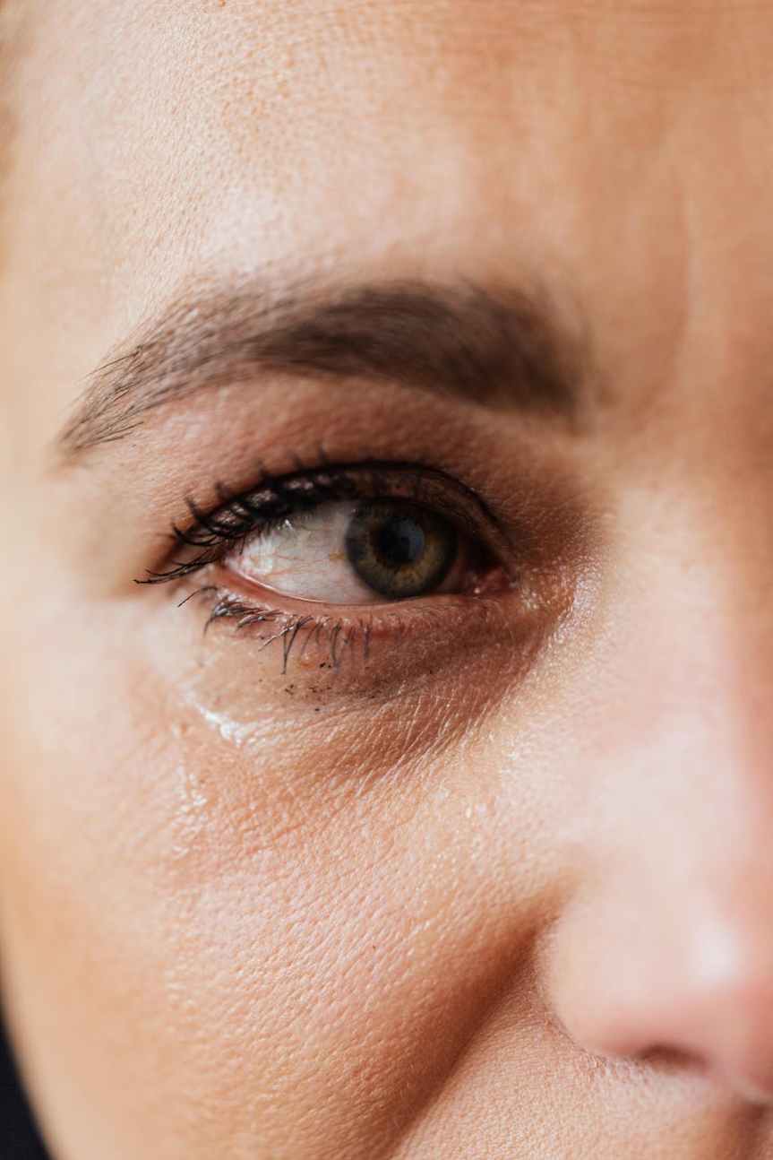 What is Eye Flu (Conjunctivitis) ?